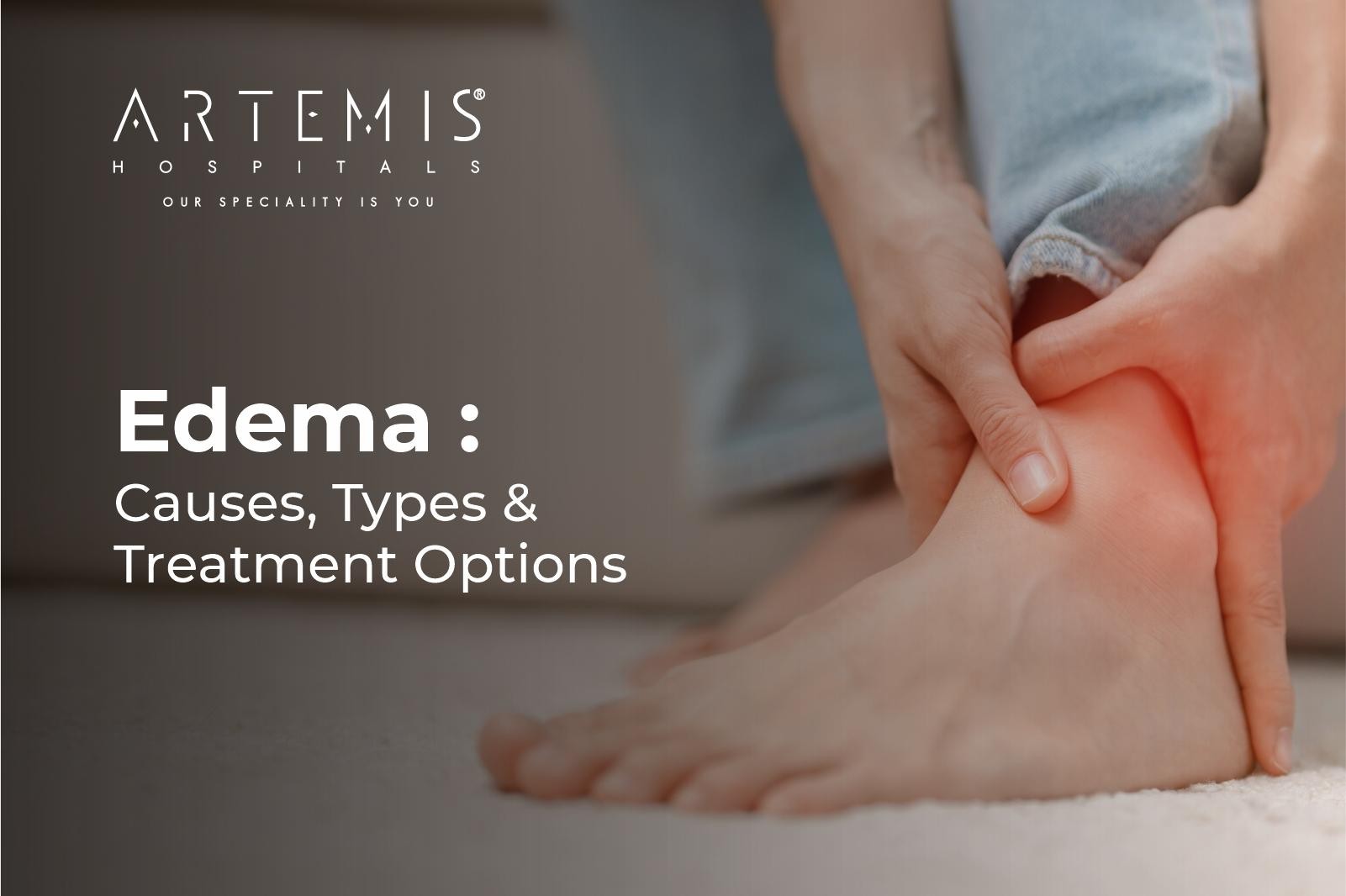 Edema Causes & Treatment Options